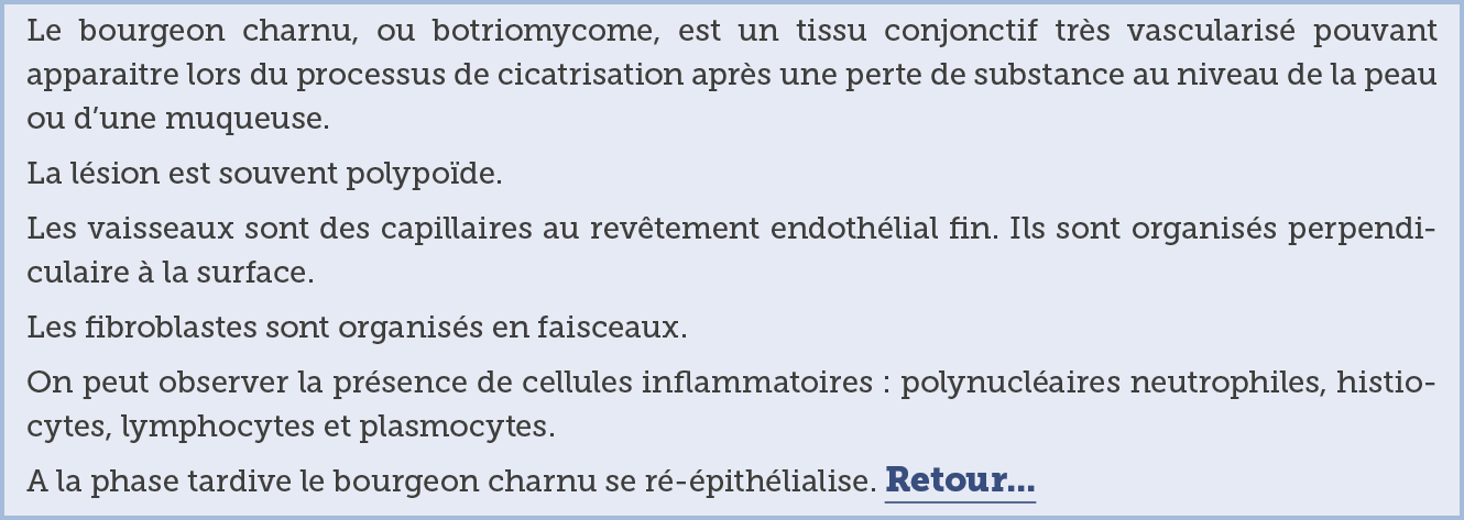 Le bourgeon charnu  ou botriomycome  est un tissu conjonctif tr s vascularis  pouvant apparaitre lors du processus de   