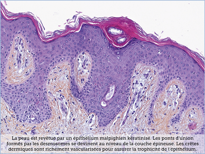 FICHE 2 TUMEUR WARTHIN VIDEO