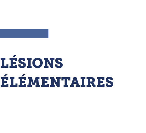 volume 1 L SIONS  L MENTAIRES