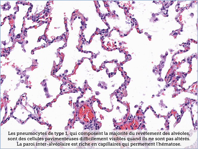 FICHE 2 TUMEUR WARTHIN ECRAN B