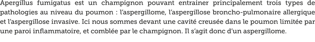 Apergillus fumigatus est un champignon pouvant entrainer principalement trois types de pathologies au niveau du poumo   