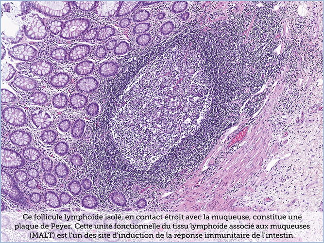 FICHE 2 TUMEUR WARTHIN VIDEO