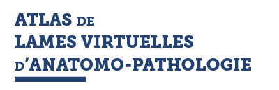 ATLAS DE LAMES VIRTUELLES D ANATOMO-PATHOLOGIE