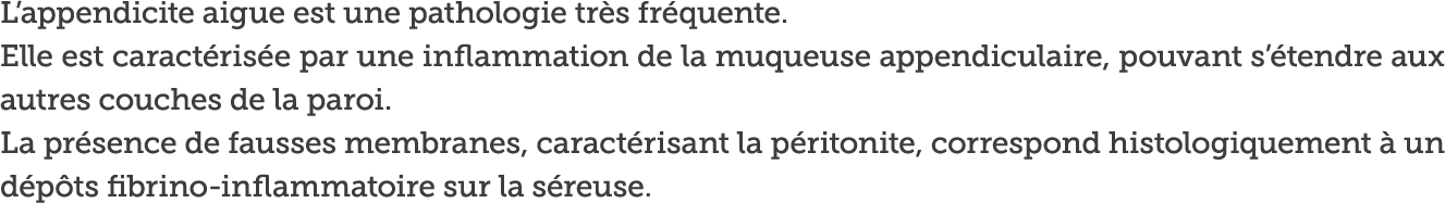 L appendicite aigue est une pathologie tr s fr quente  Elle est caract ris e par une inflammation de la muqueuse appe   