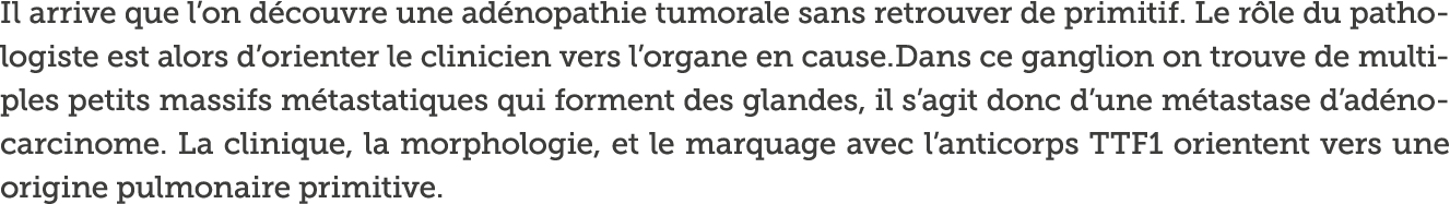 Il arrive que l on d couvre une ad nopathie tumorale sans retrouver de primitif  Le r le du pathologiste est alors d    