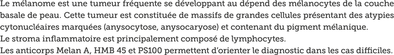Le m lanome est une tumeur fr quente se d veloppant au d pend des m lanocytes de la couche basale de peau  Cette tume   