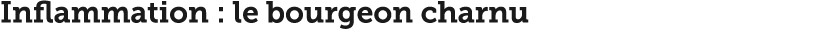 Inflammation   le bourgeon charnu